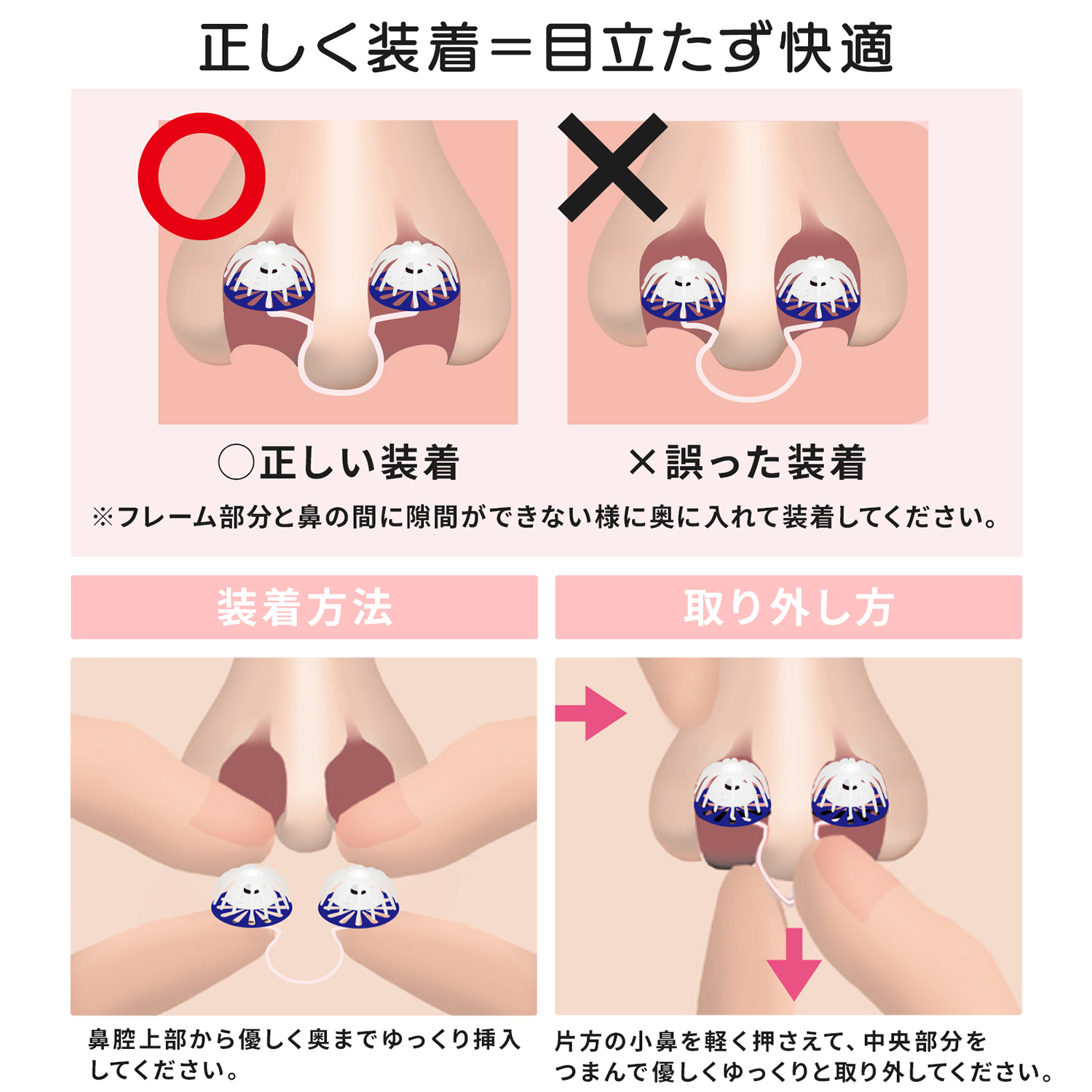 ノーズマスクピット